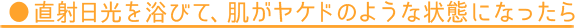 ˓𗁂тāAPĥ悤ȏԂɂȂ